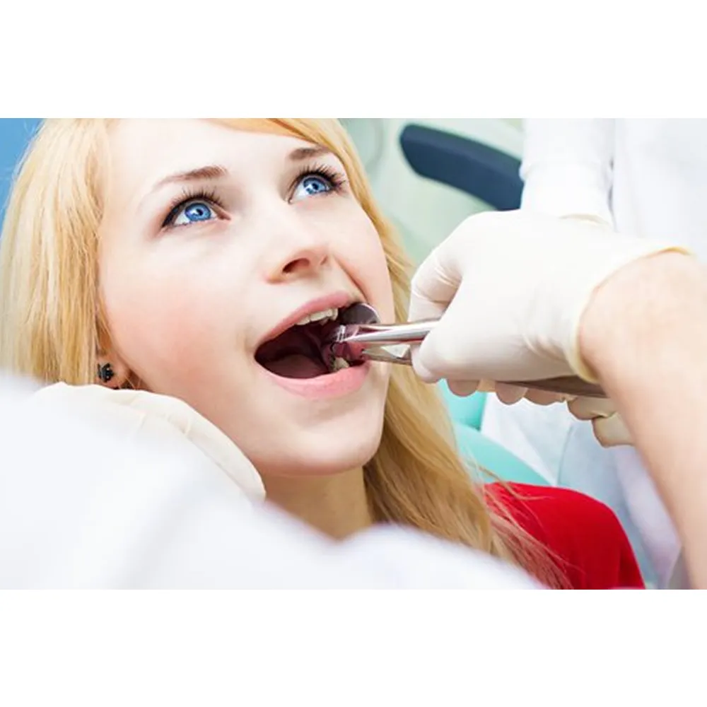 GDC Extraction Forceps Lower Roots - 959.01 Secure (SFX959.01) — Teethment catalog guide